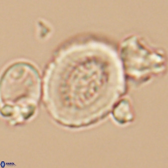 Miravetesina culverensis 10831