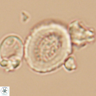Miravetesina culverensis 10831