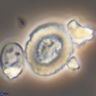 Miravetesina culverensis 10832