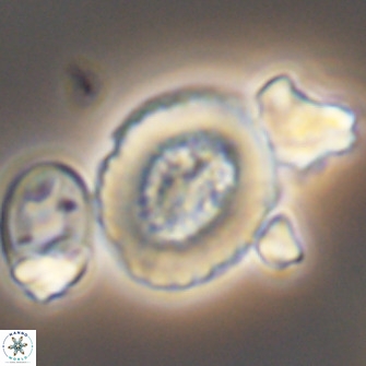 Miravetesina culverensis 10832