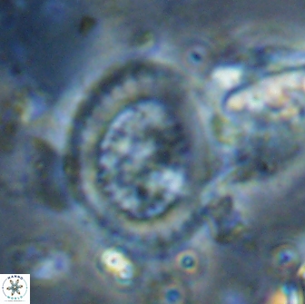 Miravetesina culverensis 14926