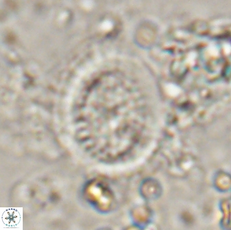 Miravetesina culverensis 14927