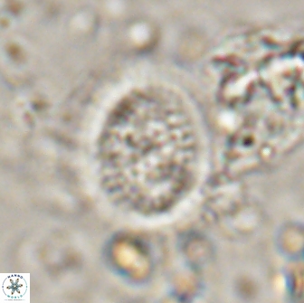 Miravetesina culverensis 14928