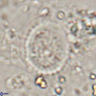 Miravetesina culverensis 14929