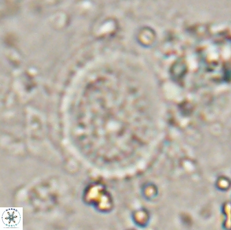 Miravetesina culverensis 14929