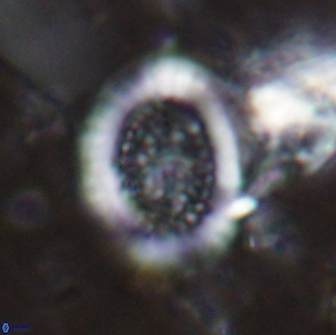 Miravetesina culverensis 14930