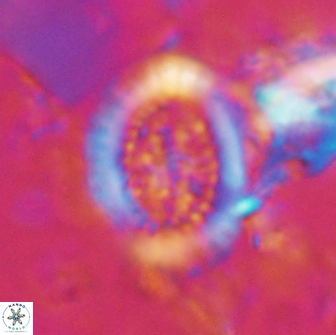 Miravetesina culverensis 14931