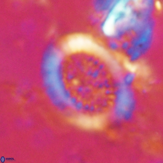 Miravetesina culverensis 14932