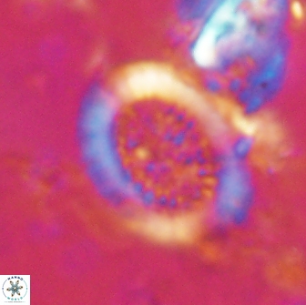 Miravetesina culverensis 14932
