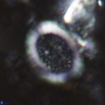 Miravetesina culverensis 14933