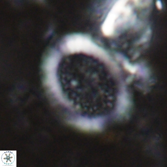 Miravetesina culverensis 14933