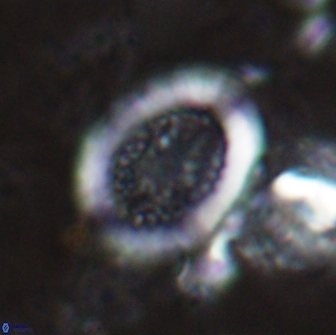 Miravetesina culverensis 14934