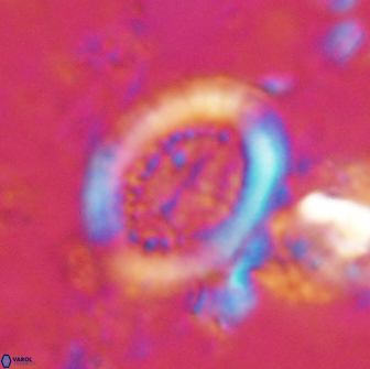 Miravetesina culverensis 14935