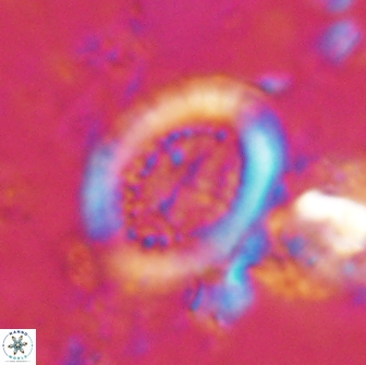 Miravetesina culverensis 14935