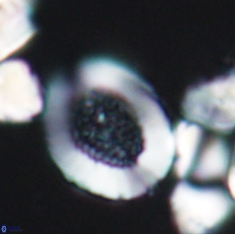 Miravetesina culverensis 6375