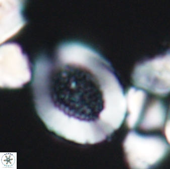 Miravetesina culverensis 6375