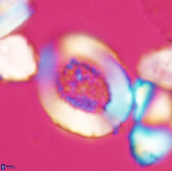 Miravetesina culverensis 6376