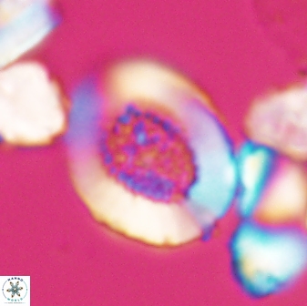 Miravetesina culverensis 6376