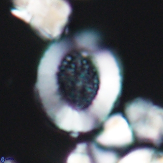 Miravetesina culverensis 6378