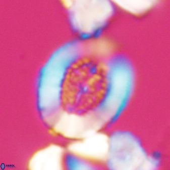 Miravetesina culverensis 6380