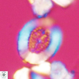 Miravetesina culverensis 6380