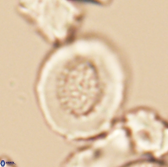 Miravetesina culverensis 6381