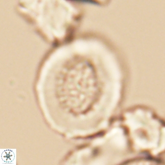 Miravetesina culverensis 6381