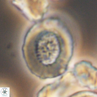 Miravetesina culverensis 6382