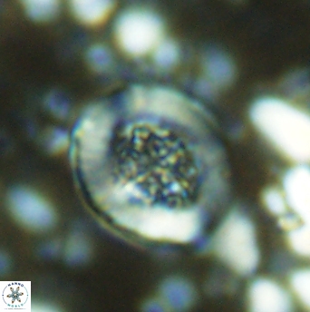 Miravetesina culverensis 6337