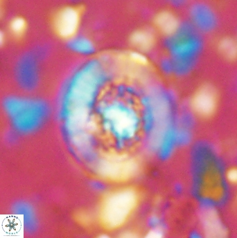 Miravetesina culverensis 6339