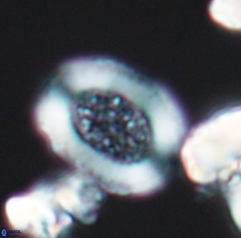 Miravetesina culverensis 6468