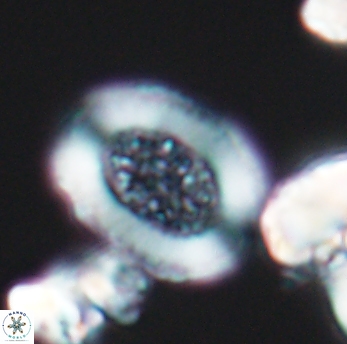 Miravetesina culverensis 6468