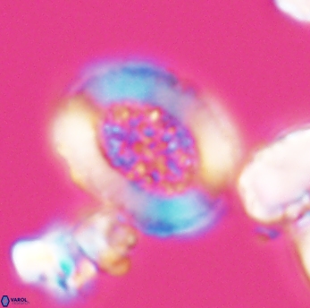 Miravetesina culverensis 6469