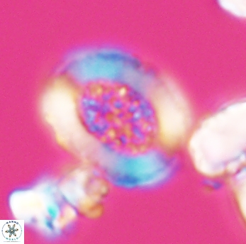 Miravetesina culverensis 6469