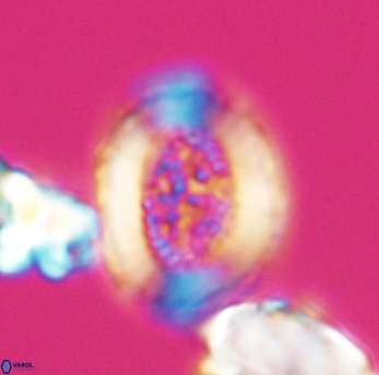 Miravetesina culverensis 6470