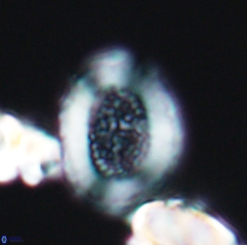 Miravetesina culverensis 6471