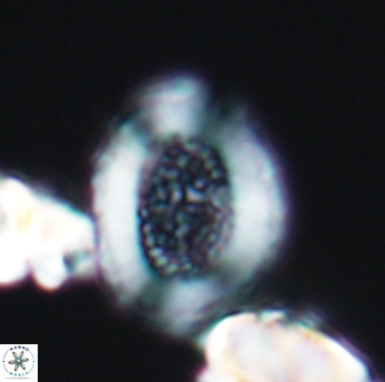 Miravetesina culverensis 6471