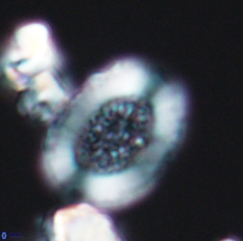 Miravetesina culverensis 6472