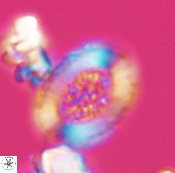 Miravetesina culverensis 6473