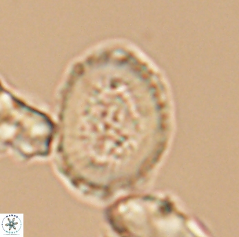 Miravetesina culverensis 6474