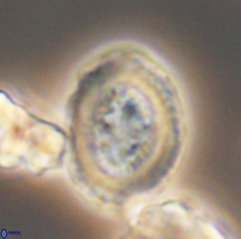 Miravetesina culverensis 6475