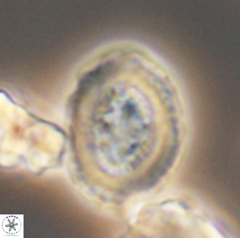 Miravetesina culverensis 6475