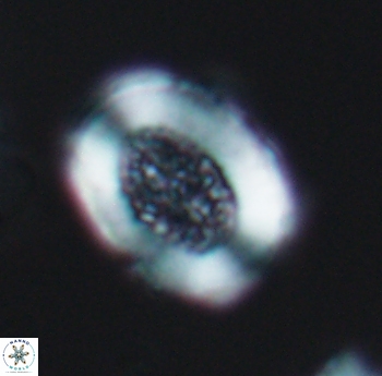 Miravetesina culverensis 6485