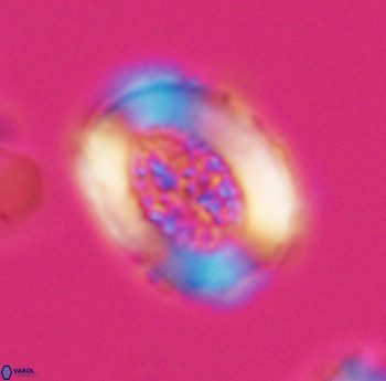 Miravetesina culverensis 6486