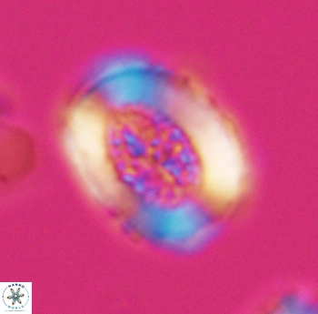 Miravetesina culverensis 6486