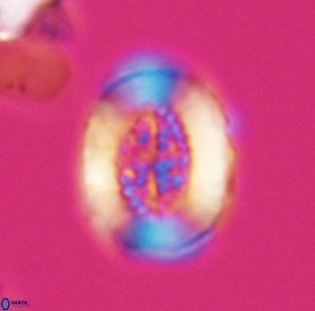 Miravetesina culverensis 6487