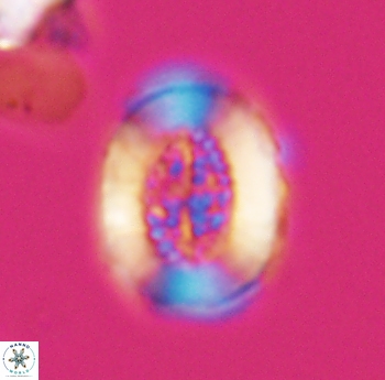 Miravetesina culverensis 6487