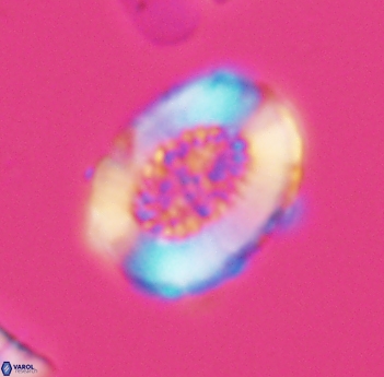 Miravetesina culverensis 6490