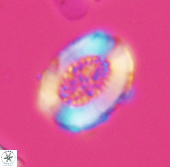 Miravetesina culverensis 6490