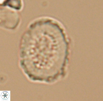 Miravetesina culverensis 6491